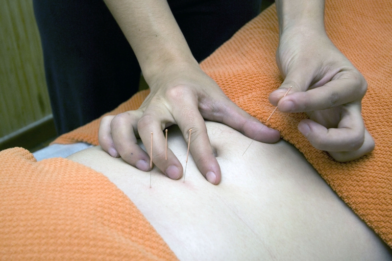 osteopathe-VILLENEUVE D ENTRAUNES-min_acupuncture-4175625